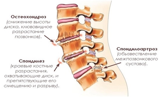 spond